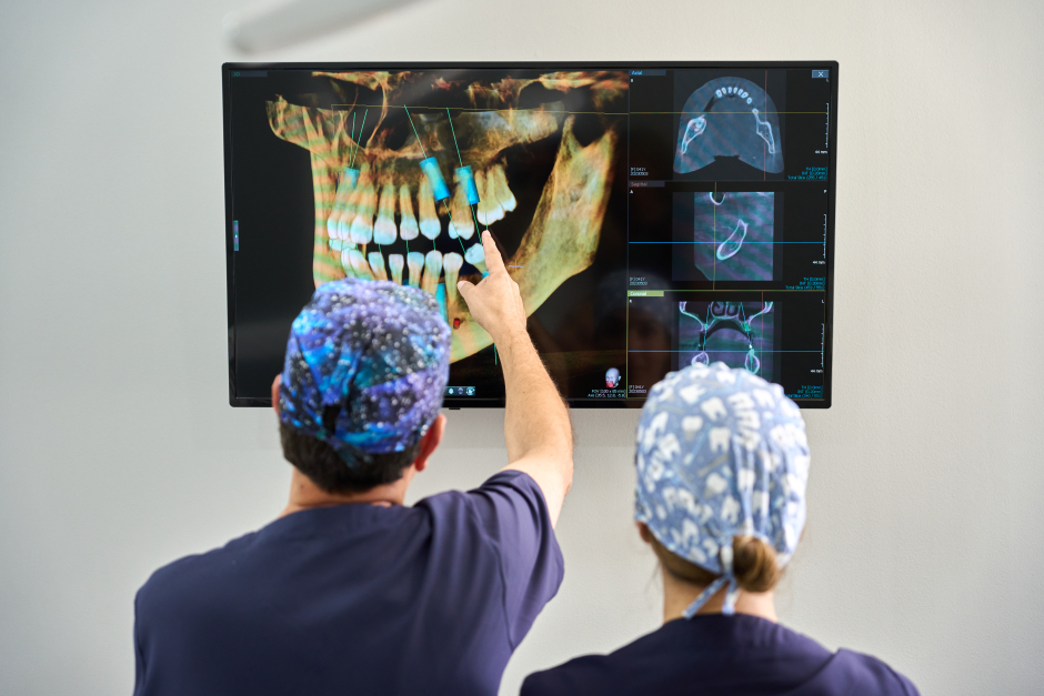Implantología Dental; qué es, aplicaciones y beneficios