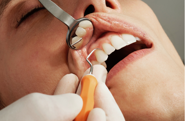 Periodoncia